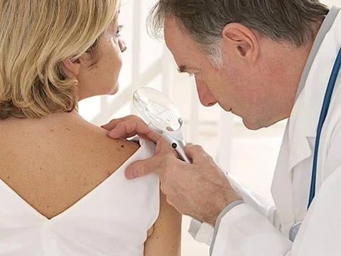 Люди с меньшим количеством родинок страдают более агрессивной формой рака кожи