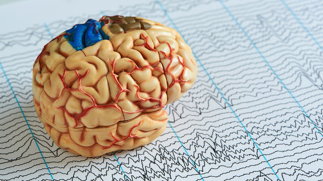 Судороги и провалы в памяти могут быть связаны с одной аномалией в мозгу при эпилепсии 