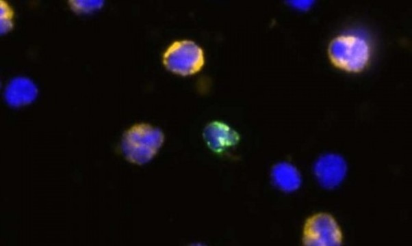 Новый неинвазивный генетический тест выявит пороки развития плода