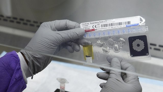 Роспотребнадзор описал три основных вида исследования на COVID-19 в стране