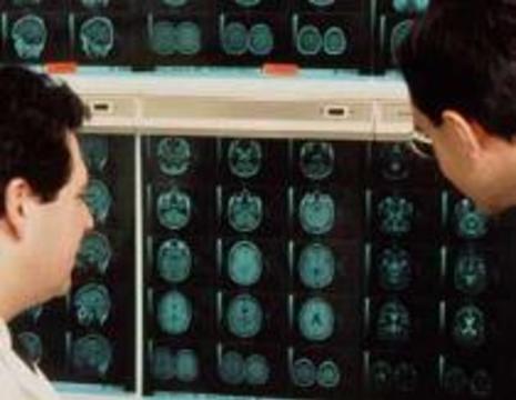 Хирурги ошиблись полушарием мозга