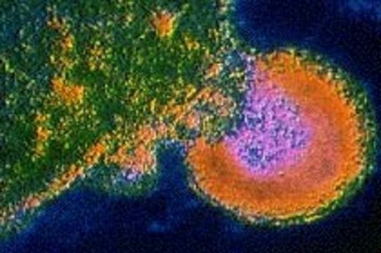 Ученые узнали, [как ВИЧ «отключает» иммунную систему организма]