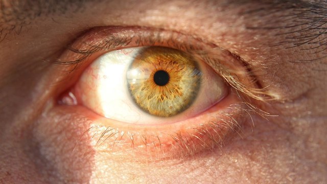 Нервный тик (дергается глаз) - причины, симптомы, лечение подергивания века