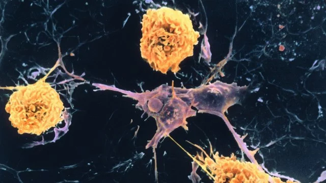 10 важных фактов о рассеянном склерозе
