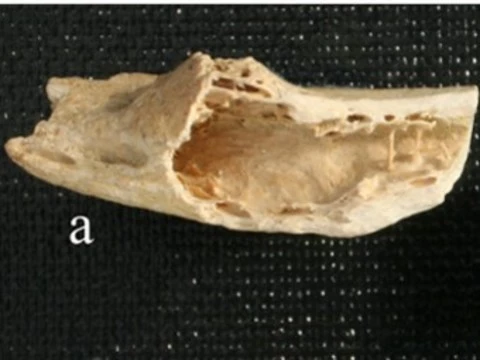 У неандертальца из хорватской пещеры нашли [современную опухоль кости]