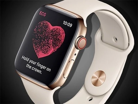 Часы Apple Watch поставили мужчине диагноз опасной аритмии сразу после включения