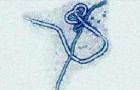 В Уганде от лихорадки Эбола умер 31 человек