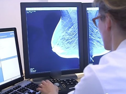 3D-скрининг рака груди обнаруживает заболевание на&nbsp;40% чаще