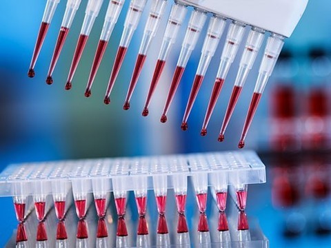 Большая клиническая апробация показала эффективность нового скрининга на синдром Дауна