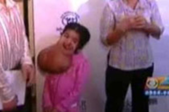 Американские хирурги избавили вьетнамскую девочку от [гигантской опухоли на лице]