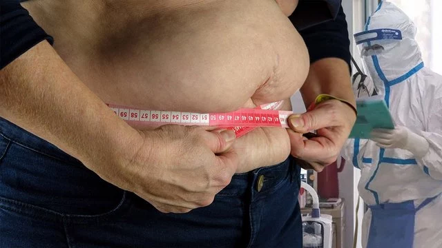 Пациенты с ожирением при COVID остаются в реанимации дольше — врач Пироговки