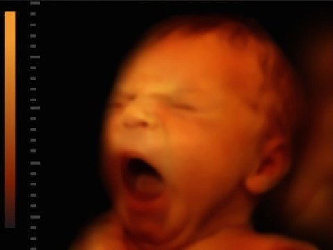Открыт молекулярный механизм в легких плода, запускающий роды