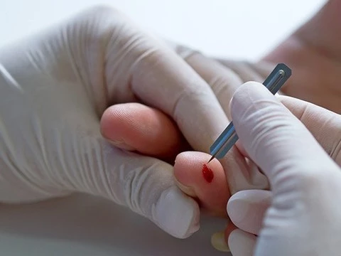 Новый тест определит все перенесенные вирусные заболевания по капле крови