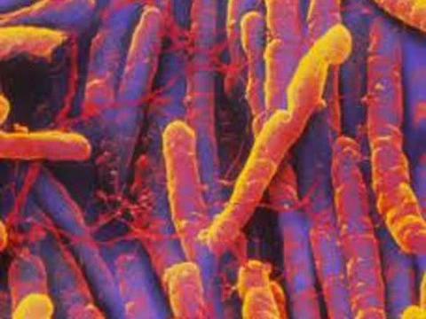 Штаммы патогенных бактерий предложили различать [по запаху фекалий]