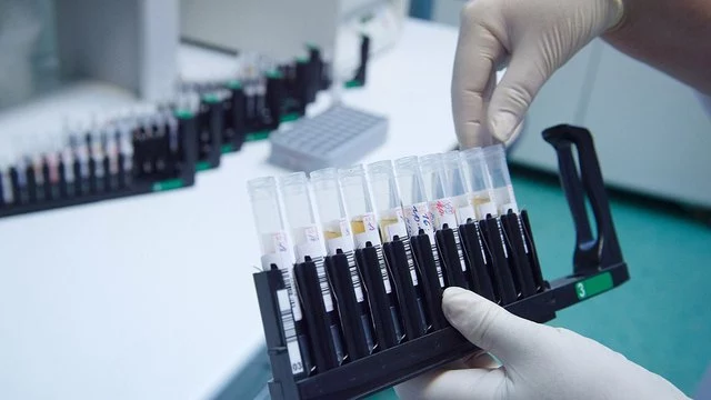 Москвичей призвали сдать бесплатный тест на наличие антител к коронавирусу