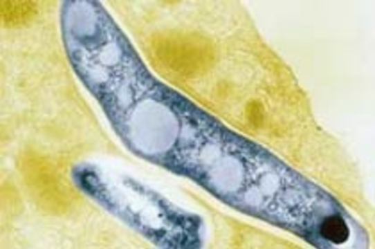 В мире распространяются неизлечимые формы туберкулеза