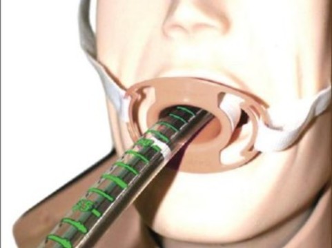 Через рот вводят. Операция через эндоскоп через рот. Разжим для рта для операции. Хирургическое уменьшение рта.