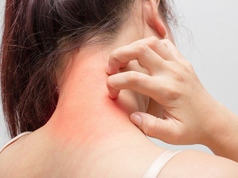 Тридерм - золотой стандарт лечения кожных заболеваний