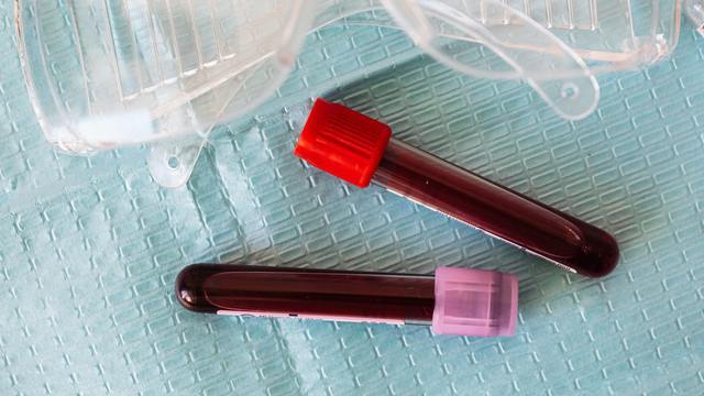 В Британии начнут использовать анализ крови для ранней диагностики более 50 видов рака