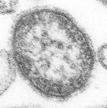 Россия потратит 329,5 млн рублей [на борьбу с корью и краснухой]