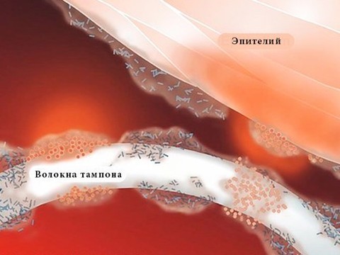 Испытания вакцины от синдрома токcического шока прошли успешно