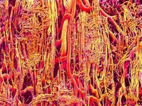 Тканевые инженеры освоили [3D-печать сети кровеносных сосудов на сахарной матрице]