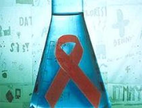 Французская вакцина сводит содержание ВИЧ в крови к минимуму