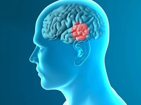 FDA одобрило мозговой стимулятор для пациентов с болезнью Паркинсона
