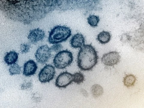 Количество смертей от коронавируса превысило 2000