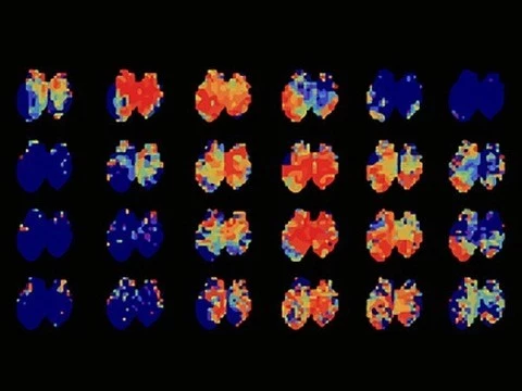 Ученые выяснили, как мозг «узнает» время года