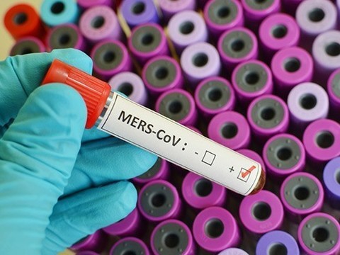 Россия получила от ВОЗ разрешение на вывоз штамма MERS из Южной Кореи