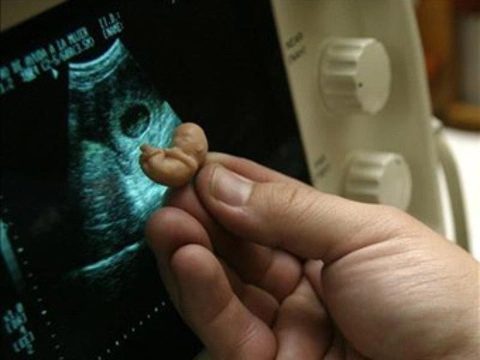 В 2011 году москвички стали делать [меньше абортов]